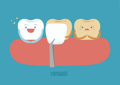 How Dental Bonding Or Veneers Can Give You A More Attractive Smile
