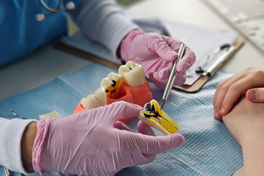 Endodontics Treatment For Tooth Pain