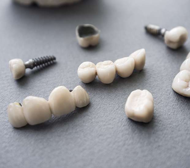 Portland The Difference Between Dental Implants and Mini Dental Implants